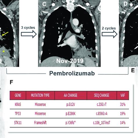 Chest Computed Tomographic CT And Positron Emission Tomography PET