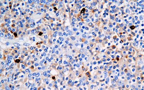 IgM Antibody - Mouse Monoclonal Antibody (Mab) IHC - Buy Now!