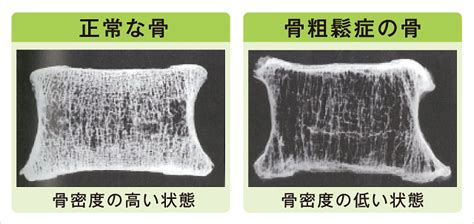 お知らせ Kin放射線治療・健診クリニック