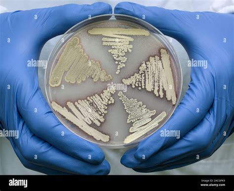 La Producci N De Antibi Ticos Bacterianos Colonias De Streptomyces