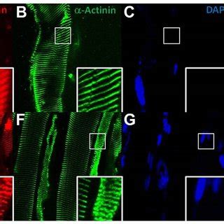 Disorganized Sarcomere Structure In Lmod Pb Pb Muscles Longitudinal