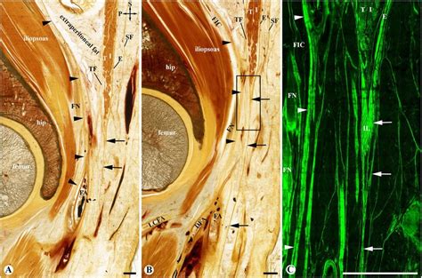origin   fascia lata   relationship   fascia