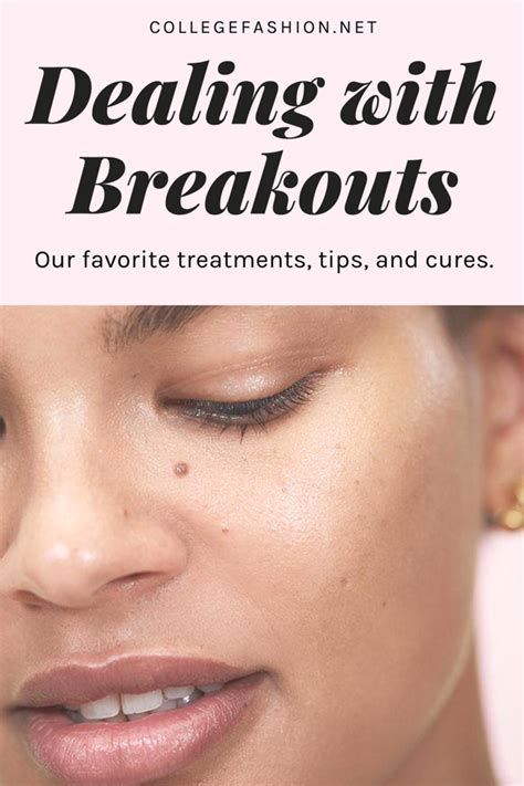 Skin Breakouts 101 A Guide To Dealing With Acne Skin Breakouts The