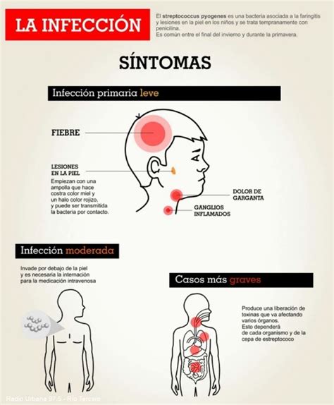 Qu Es Y C Mo Se Contagia El Streptococcus Pyogenes Mejor Informado