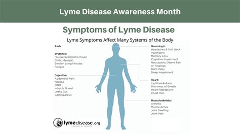 Different Stages Of Lyme Disease