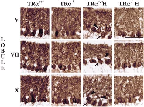 Morphology Of The Purkinje Cells In Mice Purkinje Cells Were