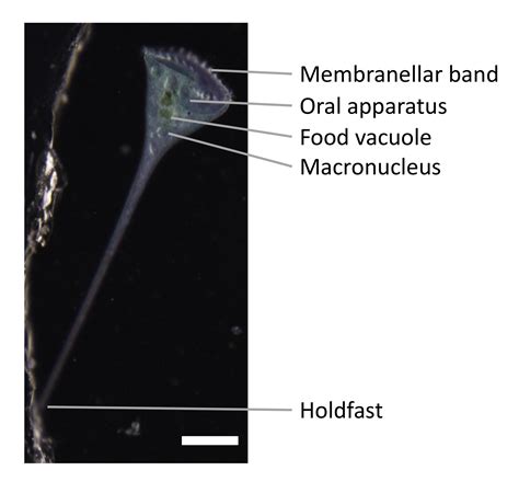 Methods for the Study of Regeneration in Stentor
