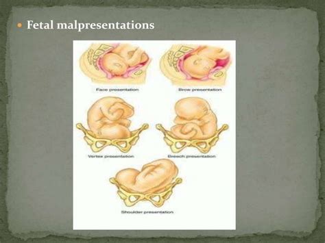 c section powerpoint presentation