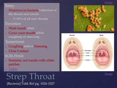 Ppt Disease Of The Day Powerpoint Presentation Id 2257021