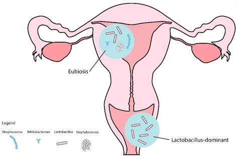 Ijms Free Full Text Clinical Relevance Of Vaginal And Endometrial