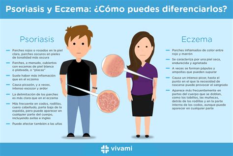 Psoriasis Y Eczema C Mo Puedes Diferenciarlos