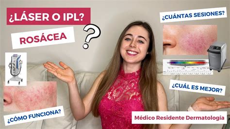 Tratamiento LÁser E Ipl Para RosÁcea ¿cÓmo Funciona ¿cuÁl Es Mejor