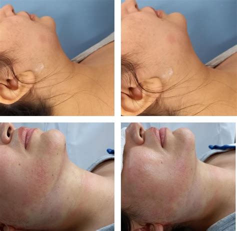 Perfilamiento Facial Dra Irene Arellano