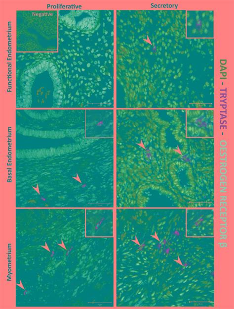 Mast Cells Are Immunopositive For Erβ Immunohistochemistry Showed