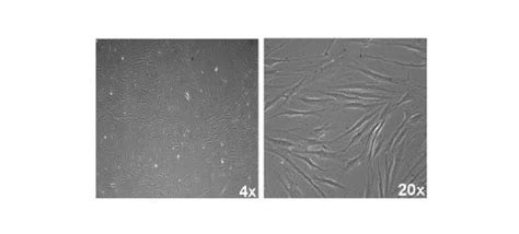 Fibroblast Cell Markers | Research Areas: Novus Biologicals