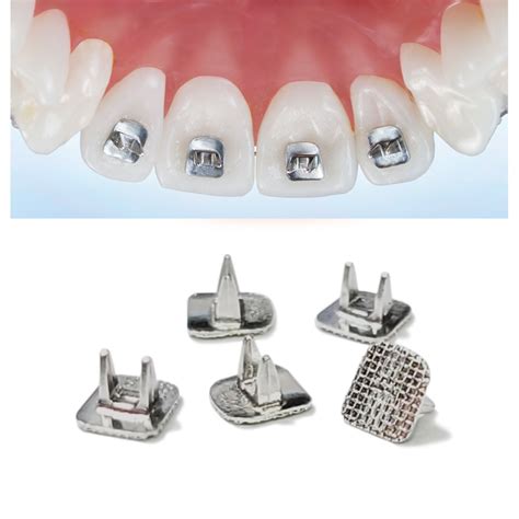 Tongue Tamers Orthodontic Supply And Equipment Company