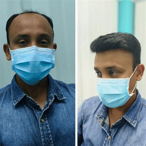 Smart Hair Fixing - Zimtro