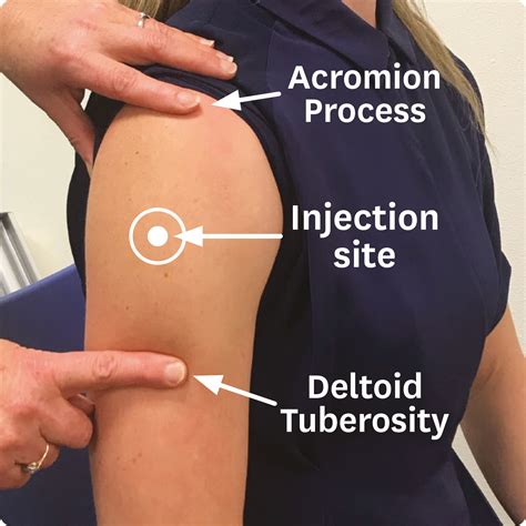 Ensuring Best Practice For Deltoid Intramuscular Vaccinations New