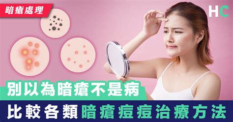 【暗瘡處理】別以為暗瘡不是病 比較各類暗瘡痘痘治療方法 Health Concept