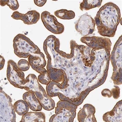 Amotl Polyclonal Antibody Invitrogen L Unconjugated Fisher