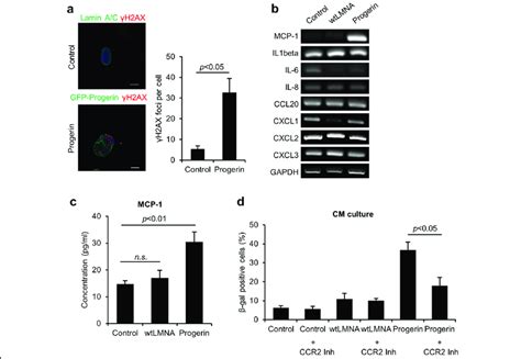 Progerin Induced Dna Damage Signaling Correlates With Mcp Expression