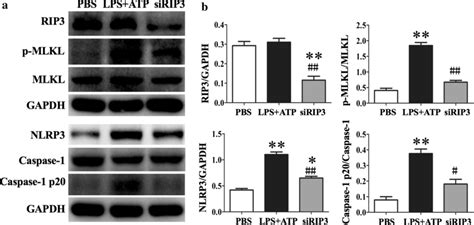 Rip3 Silencing Inhibited Lps Induced Nlrp3 Inflammasome Activation In