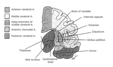 Cerebrovascular Disease Flashcards Quizlet