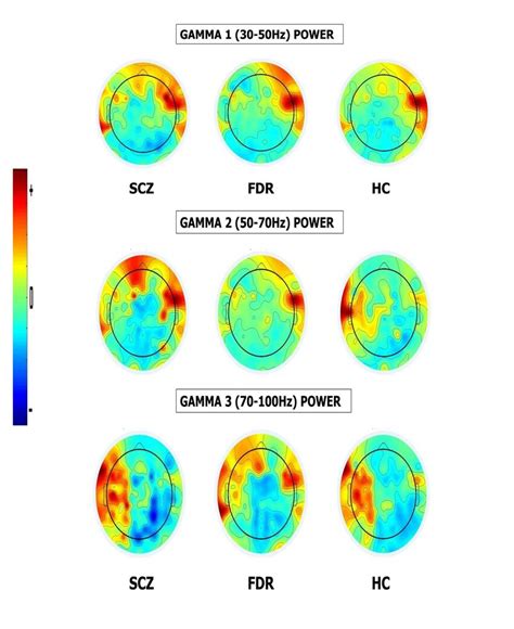 Topoplots Showing Comparison Of Gamma Power Log10 μv2 Hz In All The