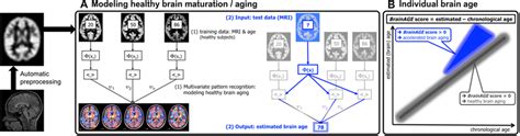 Depiction Of The Brainage Concept A Model Of Healthy Brain Aging Is Download Scientific