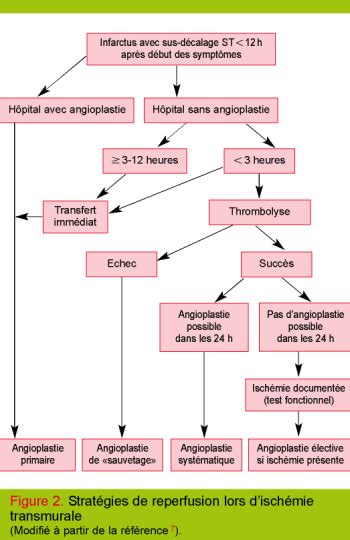 Traitement de l infarctus aigu du myocarde en 2007 Revue Médicale Suisse