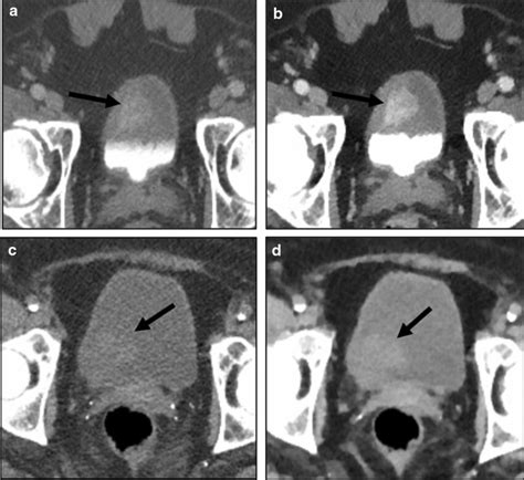 Cases Demonstrating The Need To Consistently Take Advantage Of Advanced