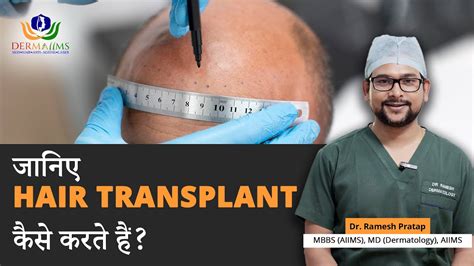 Hair Transplant Step By Step Procedure Hair Transplant Clinic In Delhi Dermaiims Clinic