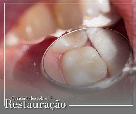 Curiosidades Sobre A Restaura O Ortocoi Cl Nica Ortod Ntica