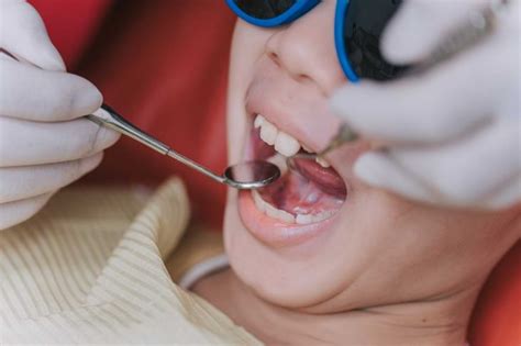 Why Do Root Canals Cost So Much Abbotsford Dental Clinic