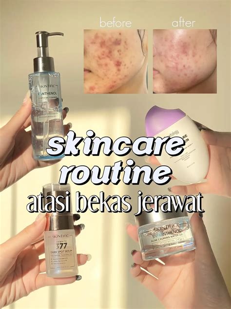 SKINCARE ROUTINE BIKIN BEKAS JERAWAT AUTO HEMPAS Galeri Diposting