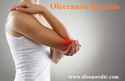 Olecranon Bursitis or Elbow Bursitis – Causes and Prevention.