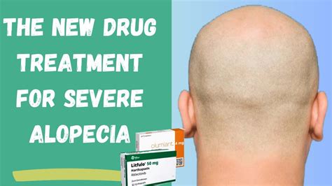 Olumiant Litfulo How Effective Are These Hair Loss Drugs For Hair