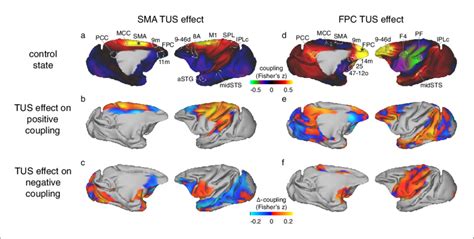 Differential Effect Of Tus On Coupling Of Activity Between Stimulated