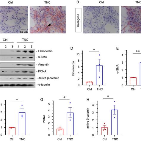 Activation Of Tenascin C Tnc Induces Mesangial Cells Mcs Fibrosis Download Scientific