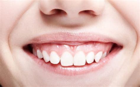 Soluciones ante una sonrisa gingival Centro Médico DLerma