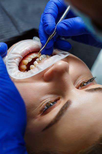 Premium Photo The Orthodontist Puts Metal Braces On The Patient S