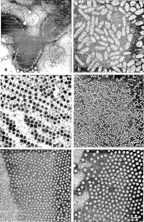 Figure 3 From An Introduction To Viruses And Techniques For Their