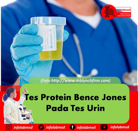 Tes Protein Bence Jones Pada Tes Urin