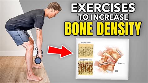 How To Increase Bone Density And Prevent Osteoporosis 5 Exercises