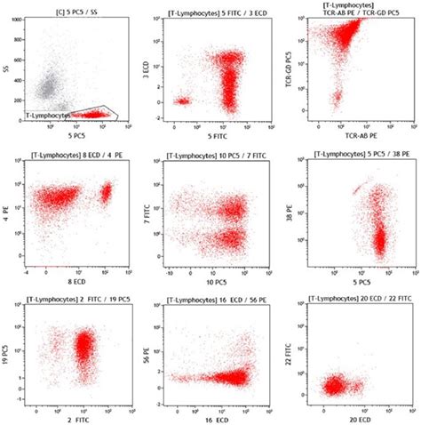 Flow Cytometric Fcm Examination Of Peripheral Blood Showed