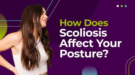 How Does Scoliosis Affect Your Posture YouTube