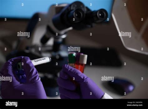 Blood Test For Syphilis Caused By The Bacterium Treponema Pallidum Or