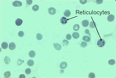 Reticulocyte Wikidoc