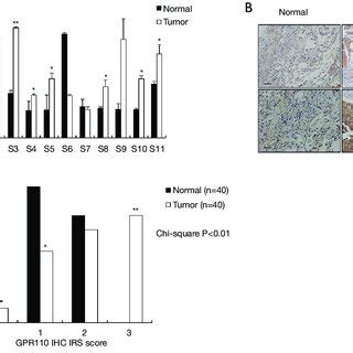 GPR110 Expression In Human Lung Cancer Tissues A GPR110 MRNA Levels