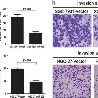 Mir Suppresses Gc Cell Migration And Invasion In Vitro Transwell